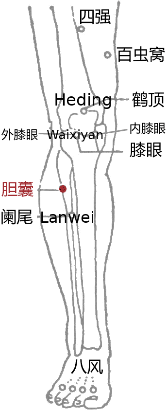 胆石点·图示