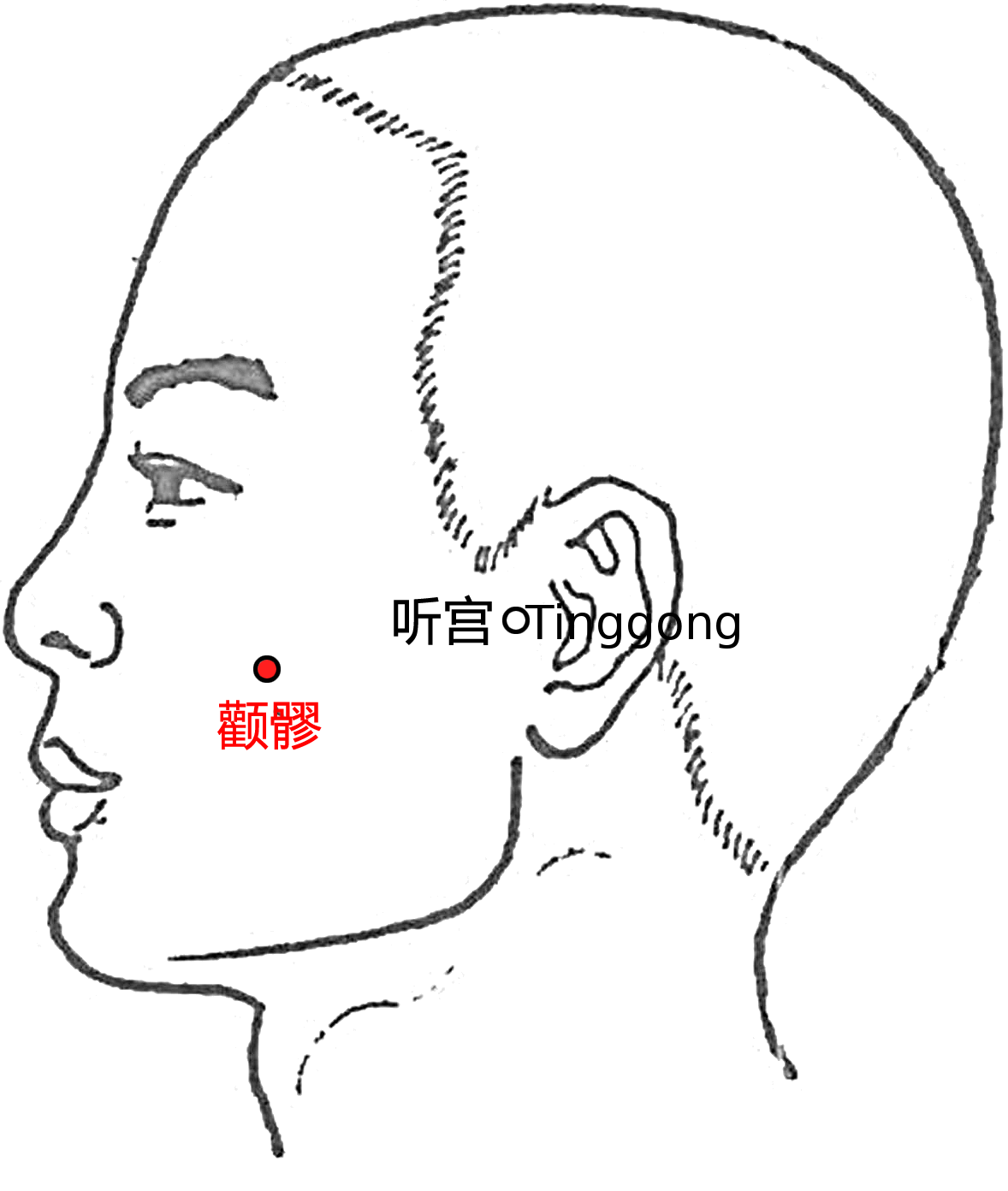 颧髎·图示