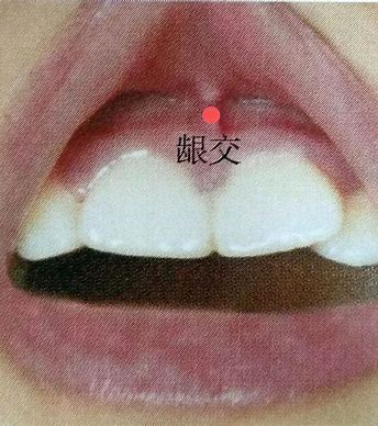 龈交·图示